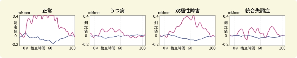 光トポグラフィー検査結果が示す症状のパターン例